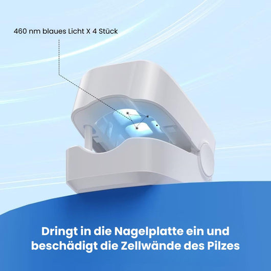 DermaNail - patentierte Nagelpilz-Therapie - für gesunde Nägel innerhalb von 4 Wochen